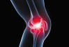 膝关节炎要对症治！护膝试试“4+4”
