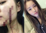讽刺！贵州女孩合租屋被砍毁容报警1个多月无进展　发微博1天4嫌犯全抓获